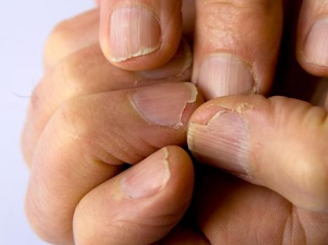 Самые полезные недорогие витамины для ногтей